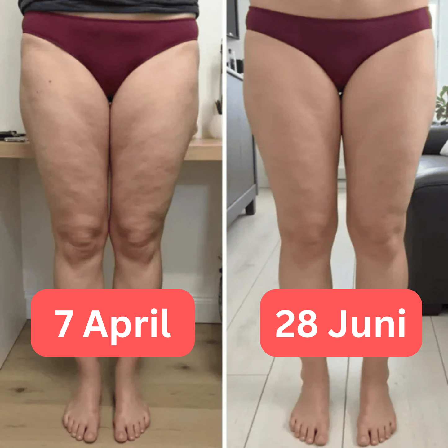 Anti Cellulite Leggings - 3D Kompression | BLACK NOVEMBER SALE